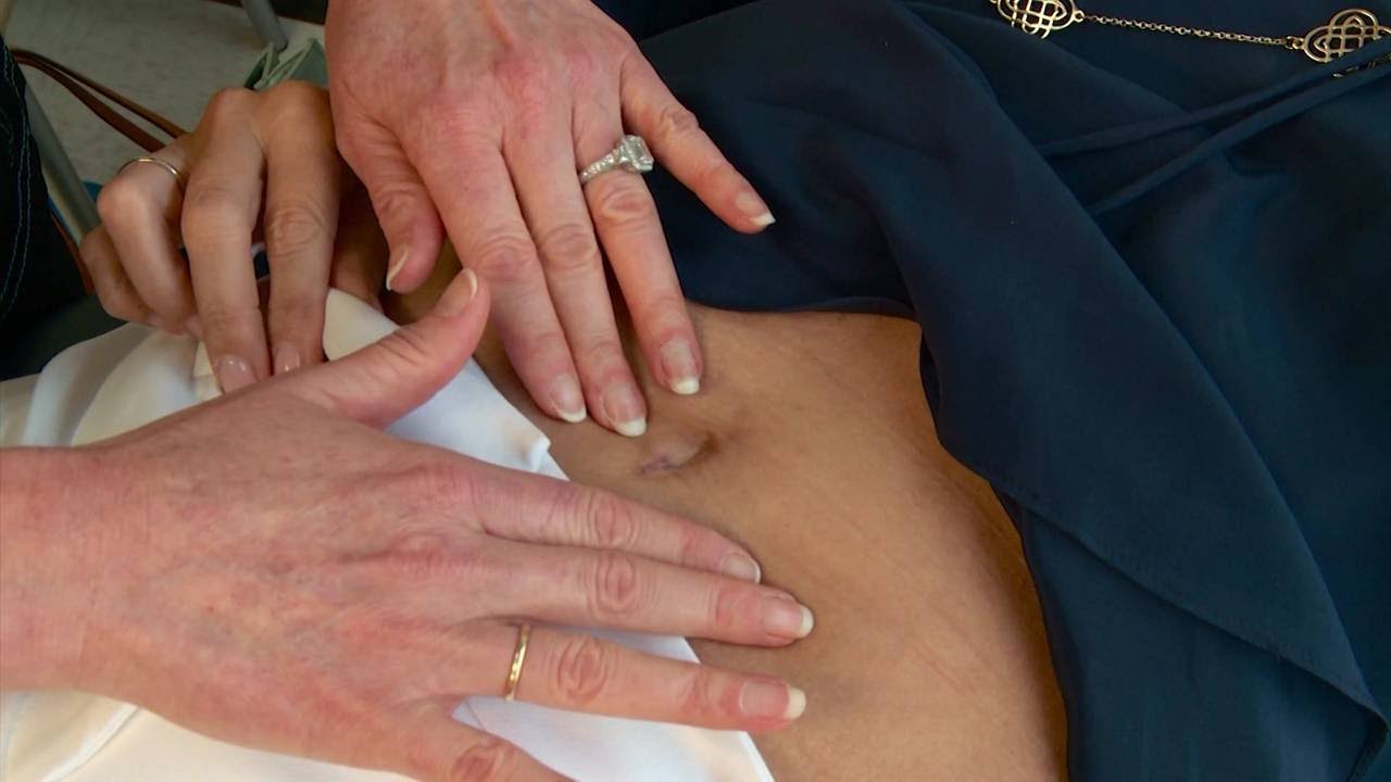 Less invasive hysterectomy options