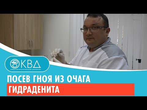 ✅ Посев гноя из очага гидраденита. Клинический случай №555