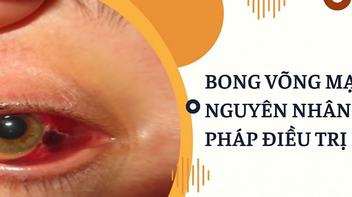 Phẫu thuật bong võng mạc bao nhiêu tiền năm 2024