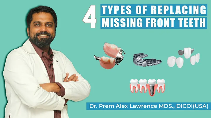 4 Types for replacing missing front teeth | Dr Prem in English | Bridges Vs Implants Vs Dentures