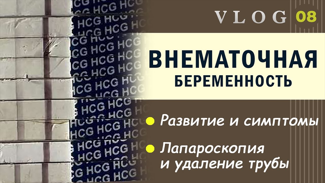ЭКО. Внематочная беременность после ЭКО // Развитие и признаки // Лапароскопия