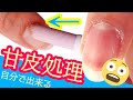 【甘皮処理】おうちで出来るセルフネイルケア★簡単な甘皮除去のやり方！セルフネイルの事ならあわちゃんねるで♪