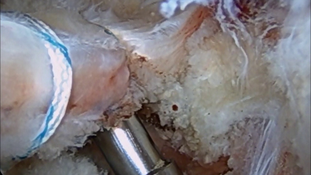 TALR Technique camera iphone 8 plus apk