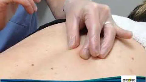 Intramuscular Stimulation with Mark Tsai