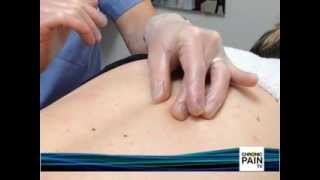 Intramuscular Stimulation with Mark Tsai
