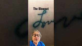 The Blowout Tattoo and How To Resolve it: Dr. Messina Explains