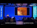 i-EUS VedVision Cecilia Binda
