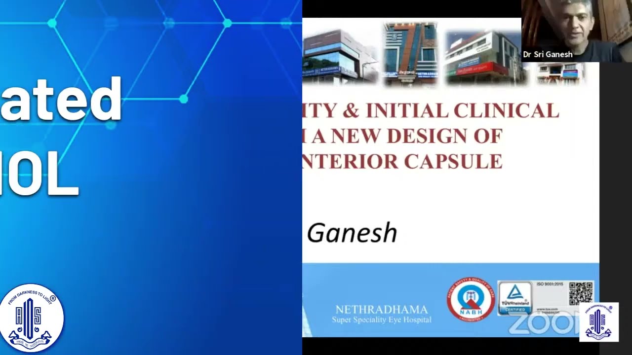 Innovations @ AIOS -2020 : Capsulotomy fixated Swivel haptic IOL Dr. Sri Ganesh