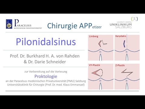 Video: Pilonidale Zystenchirurgie: Verfahren, Genesung Und Rezidiv