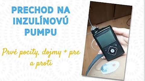 Co je dynamické těsnění vodní pumpy?