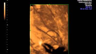 IMG 20130717 1 5 VolCine