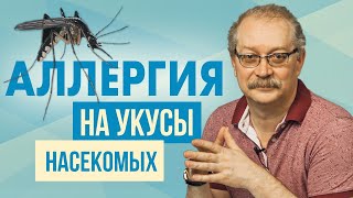 Должен знать каждый! Укусы насекомых и защита от них, Как мы реагируем, и кто нас кусает?