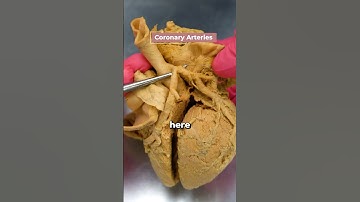 Heart Attack: This is the Cause