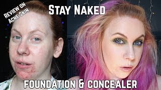 Urban Decay Stay Naked Foundation & Concealer Review on Acne Skin