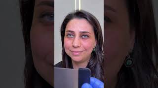 Aşağı qaş #keşfetbeniöneçıkar #qaş #kesfet #nanobrows