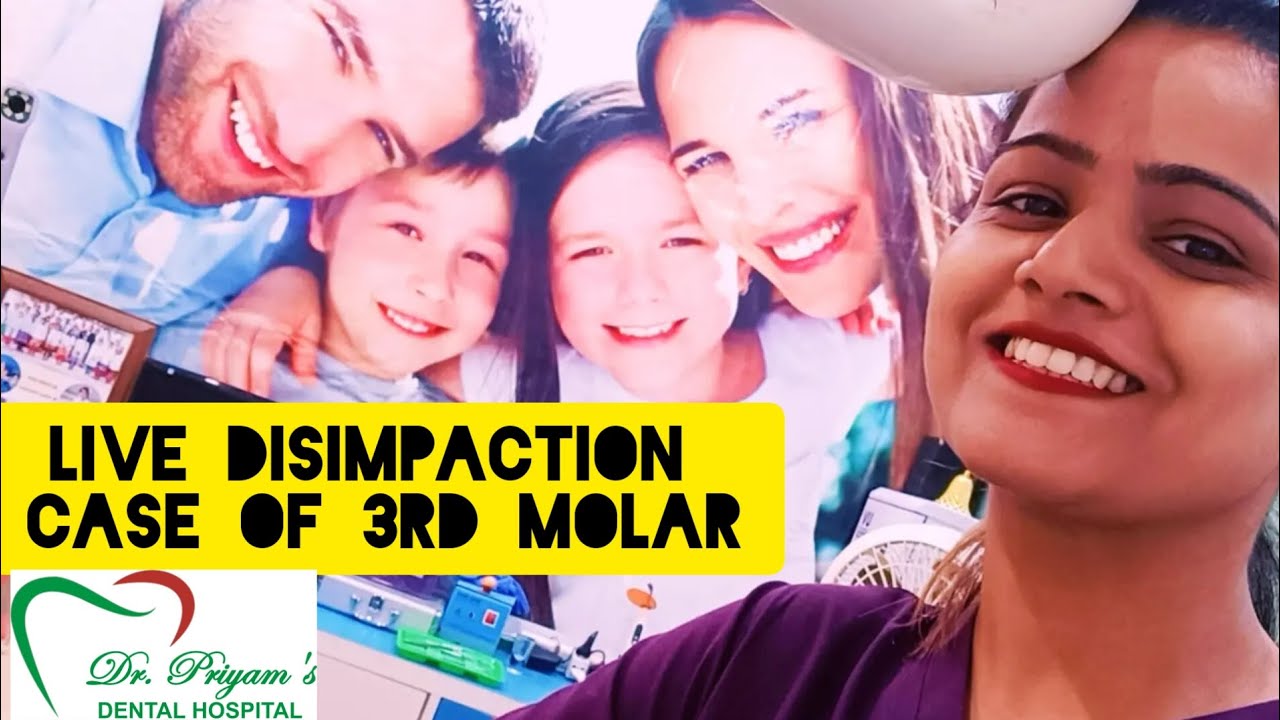 LIVE DISIMPACTION || Lower Third Molar || Dr Priyam kesarwani || BDS ...