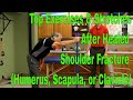Top Exercises & Stretches After Healed Shoulder Fracture (Humerus, Scapula, or Clavicle)