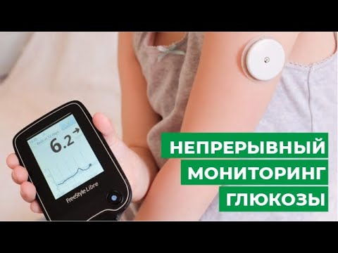 Непрерывный мониторинг глюкозы