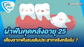 ผ่าฟันคุดหลังอายุ 25 เสี่ยงรากฟันชนเส้นประสาทจริงหรือไม่ ? | รู้ทันกันได้