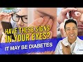 5 Dangerous Diabetes Signs in Your Eyes You Must Know About!