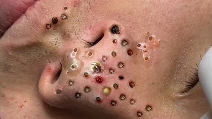 𝑨𝒄𝒉𝒊𝒆𝒗𝒆 𝑰𝒏𝒏𝒆𝒓 𝑷𝒆𝒂𝒄𝒆 𝑾𝒊𝒕𝒉 𝑻𝒉𝒆𝒔𝒆 𝑭𝒂𝒄𝒊𝒂𝒍 𝑪𝒍𝒆𝒂𝒏𝒔𝒊𝒏𝒈 𝑴𝒆𝒕𝒉𝒐𝒅𝒔 #964735