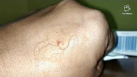 Is it OK to use KY Jelly everyday?