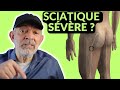 Sciatique svre ou pas  la boite  questions