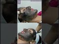 How to get instant glow ? | Glowing skin in 15 minutes | Carbon facial | Hollywood Facial |
