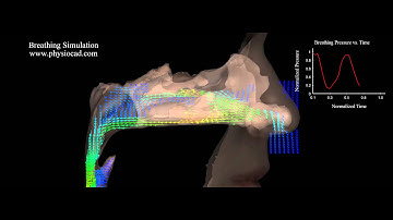 Virtual Nasal Flow using CFD by www.PhysioCAD.com