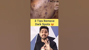 Remove Dark Spots, Pimple Marks From Face #darkspots #skincare #tips #shorts