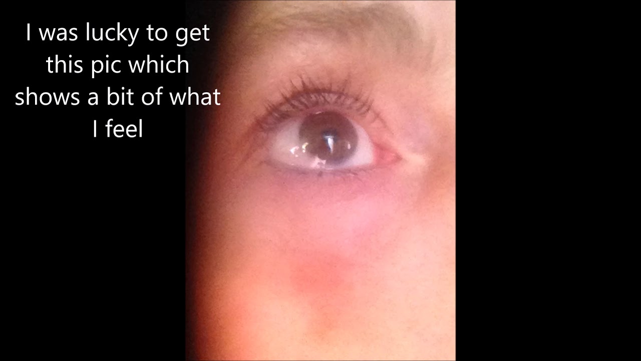 & Slime Mold Eyes are not the same. YouTube