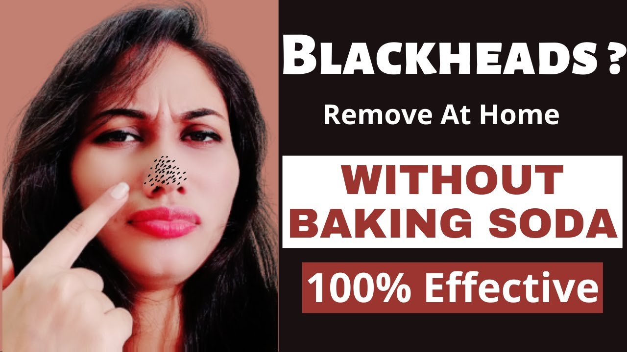 Blackheads Removal Easy Way To Remove Blackheads Fast Natural