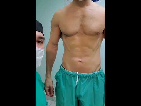 Lipoescultura Láser HD