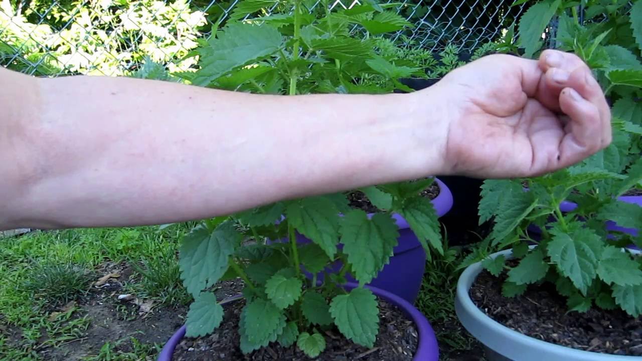 Getting Stung By Stinging Nettle (Intentionally) - Youtube