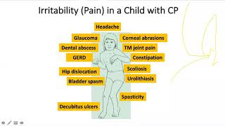 Motor examination in children with Cerebral palsy Explained