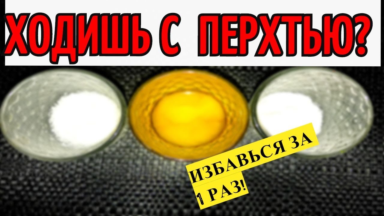 ИЗБАВИТЬСЯ ОТ ПЕРХОТИ ЗА ОДИН ДЕНЬ!ПОМОЖЕТ ЭТОТ РЕЦЕПТ - YouTube