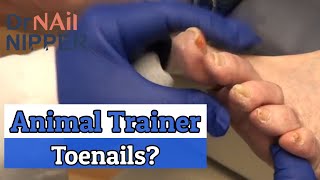 Dr Nail Nipper Cutting Curly Toenail; Animal Trainer?