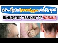 How to treat psoriasis (Psora) with homeopathic medicine [Urdu-Hindi] Dr. Nauman Ahmad