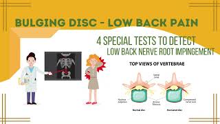 Nerve Root Impingement/Bulging Disc - Low Back Pain Special Tests