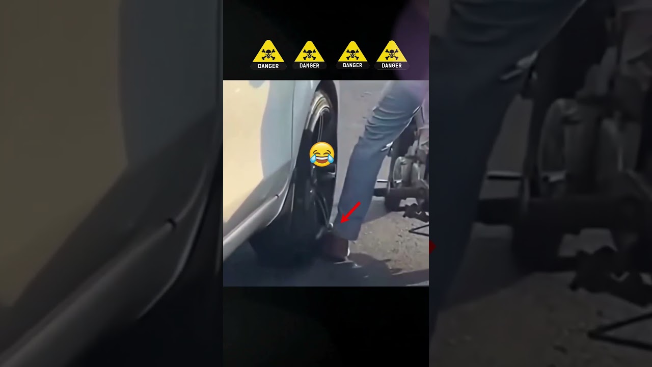 his leg was hit by a car