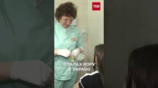 Спалах кору в Україні! Чи вистачить вакцин?