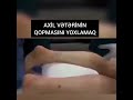 simmonds testi tompson testi axil veterinin qopmasini yoxlamaq veter cirilmasi travmatologiya cerrah
