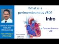 What is a perimembranous VSD? Intro