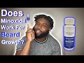 Does Minoxidil Work For Beard Growth ? And is it Safe ?
