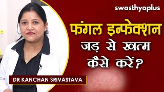 क्या है फंगल इन्फेक्शन? | Dr Kanchan Srivastava on Fungal Infection in Hindi | Causes & Treatment
