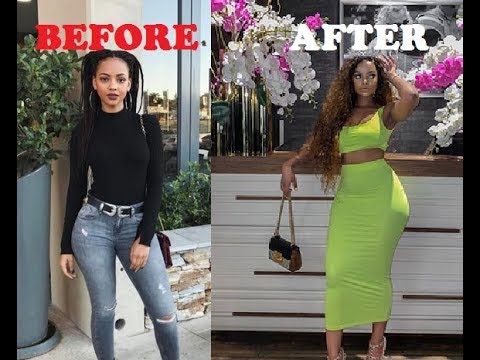 How Many Surgeries Did Mihlali Ndamase Get If Any YouTube how-many-surgeries-did-mihlali-ndamase-get-if-any-youtube