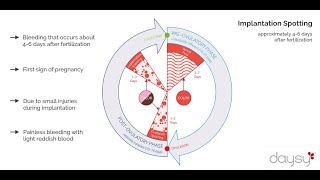 Spotting vs Period - Ovulation Spotting, Implantation Spotting, Menstruation