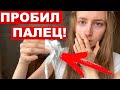 БОЛЬНО ДО СЛЕЗ УКУСИЛ ПОПУГАЙ! КАК ОТУЧИТЬ ПОПУГАЯ КУСАТЬСЯ?  ПОЧЕМУ ПОПУГАЙ КУСАЕТ?