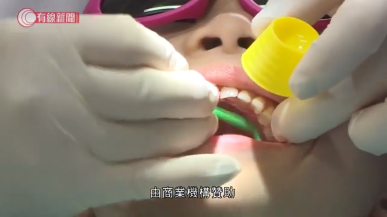 港大醫學院推新服務 為學前兒童檢查牙齒 - 20200115 - 香港新聞 - 有線新聞 CABLE News