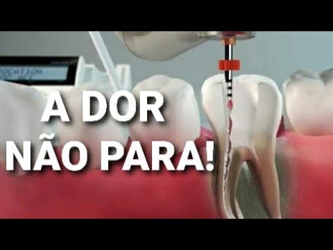 Fiz CANAL e MEU DENTE está DOENDO! POR QUE CONTINUA a DOER? - YouTube